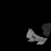 SPORK, NICO - 22.03.1976 - 02.08.2022 - CT obere Extremität - 17:51:17